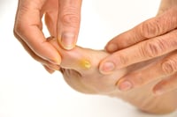 Person inspecting foot with a sore